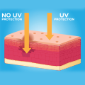 Rosacea Rosacea