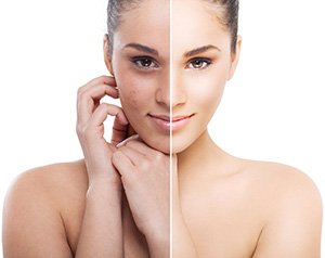 makari-exklusive-peeling