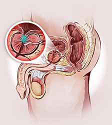 wie funktioniert die prostata